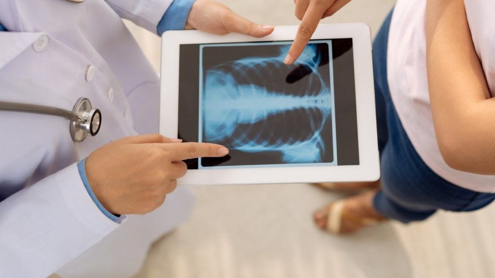 Doctor showing a patient their x-ray